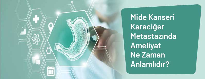 Mide Kanseri Karaciğer Metastazında Ameliyat Ne Zaman Anlamlıdır?